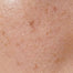 Combination skin